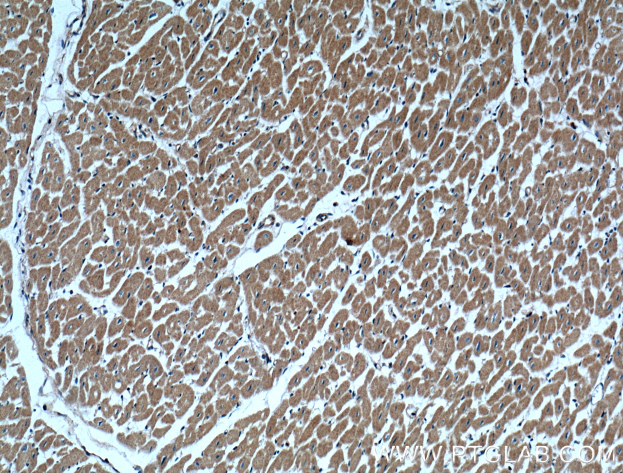 Immunohistochemistry (IHC) staining of human heart tissue using Alpha Actinin Polyclonal antibody (11313-2-AP)