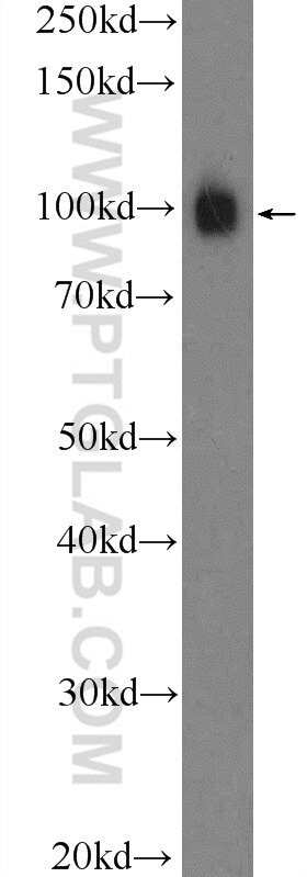 WB analysis of mouse spleen using 11313-2-AP