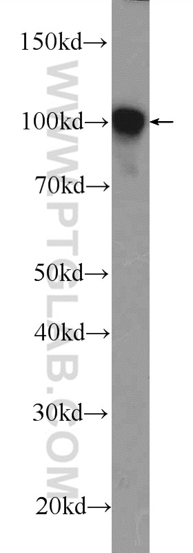 Alpha Actinin Polyclonal antibody