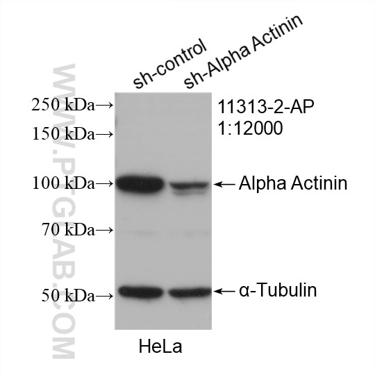 Western Blot (WB) analysis of HeLa cells using Alpha Actinin Polyclonal antibody (11313-2-AP)