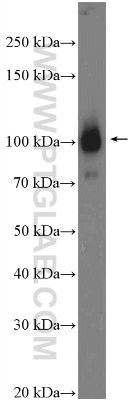 Western Blot (WB) analysis of rat heart tissue using Alpha Actinin Polyclonal antibody (11313-2-AP)