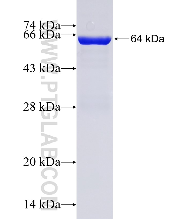 a-Actinin fusion protein Ag1859 SDS-PAGE