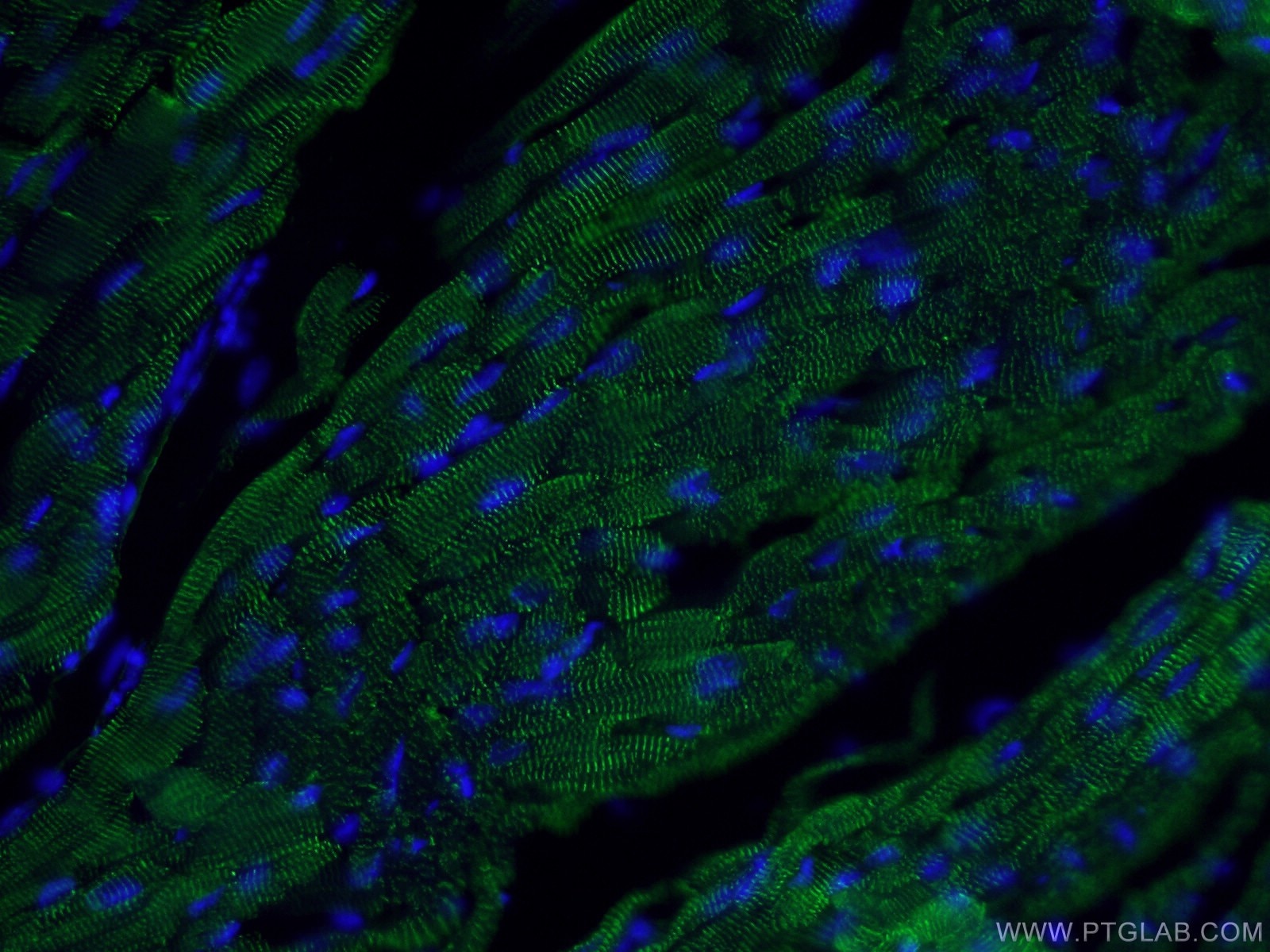 IF Staining of mouse heart using 14221-1-AP
