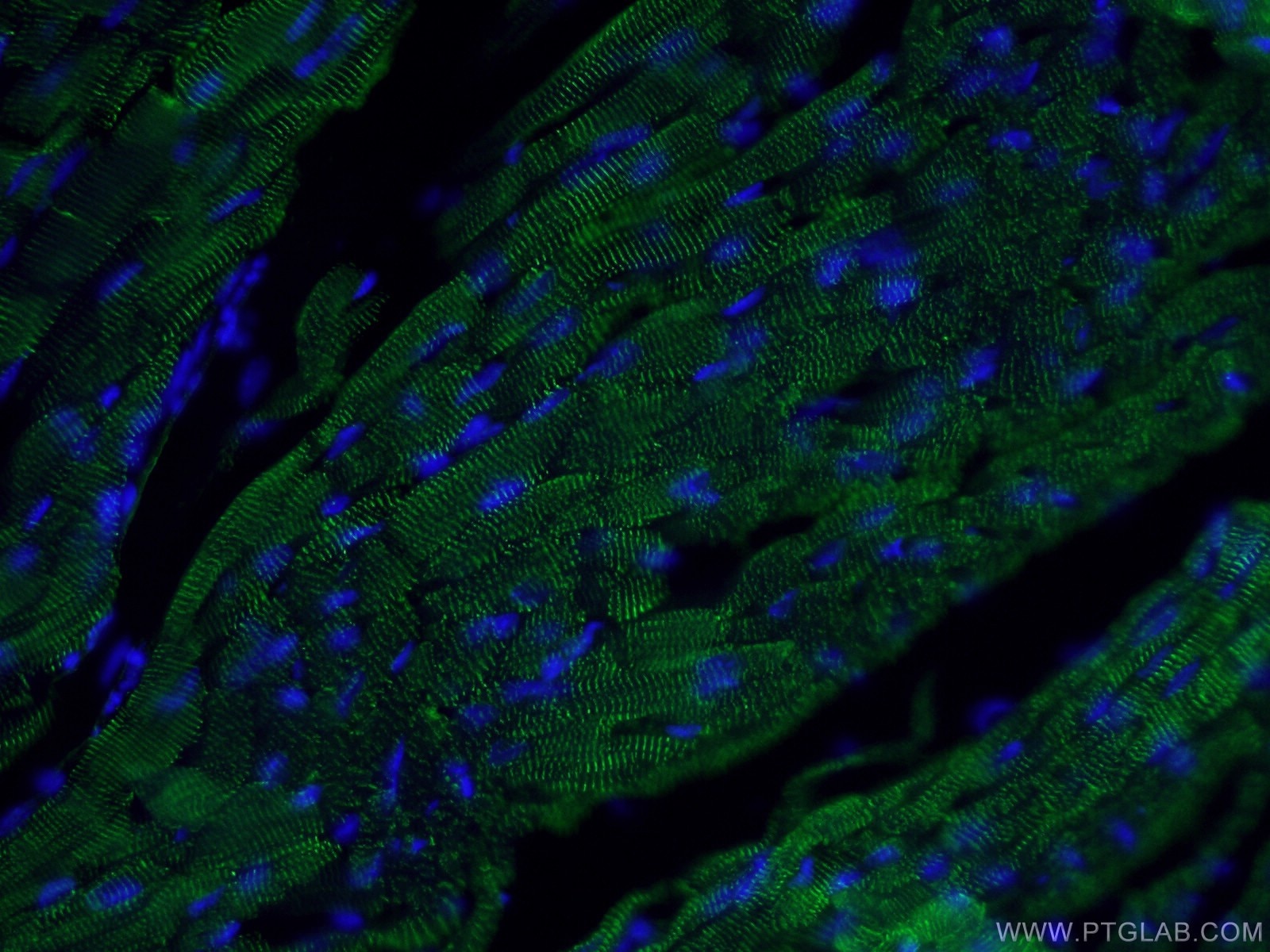 Immunofluorescence (IF) / fluorescent staining of mouse heart tissue using ACTN2 Polyclonal antibody (14221-1-AP)