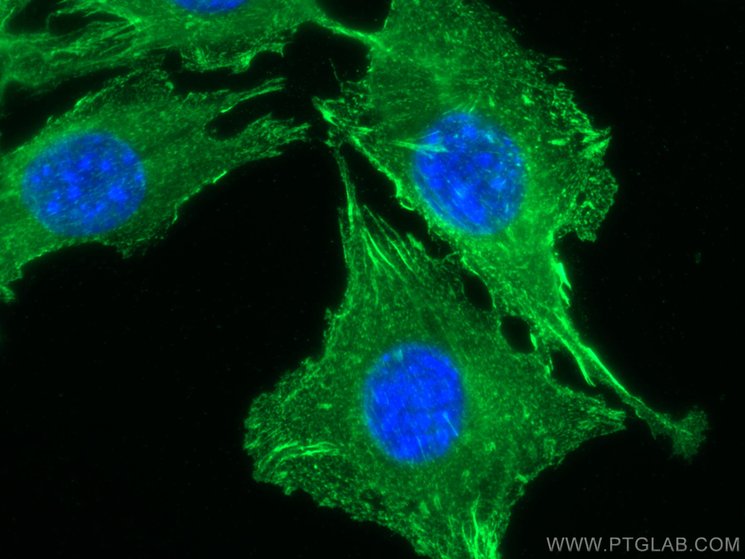 Immunofluorescence (IF) / fluorescent staining of C2C12 cells using ACTN2 Polyclonal antibody (14221-1-AP)