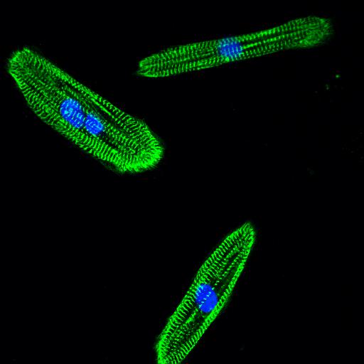 Immunofluorescence (IF) / fluorescent staining of Human iPSC derived cardiomyocyte using ACTN2 Polyclonal antibody (14221-1-AP)