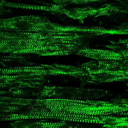 Immunofluorescence (IF) / fluorescent staining of mouse heart tissue using ACTN2 Polyclonal antibody (14221-1-AP)