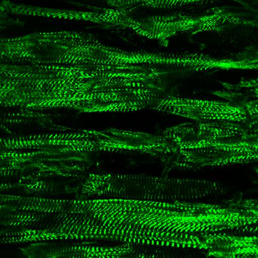 IF Staining of mouse heart using 14221-1-AP