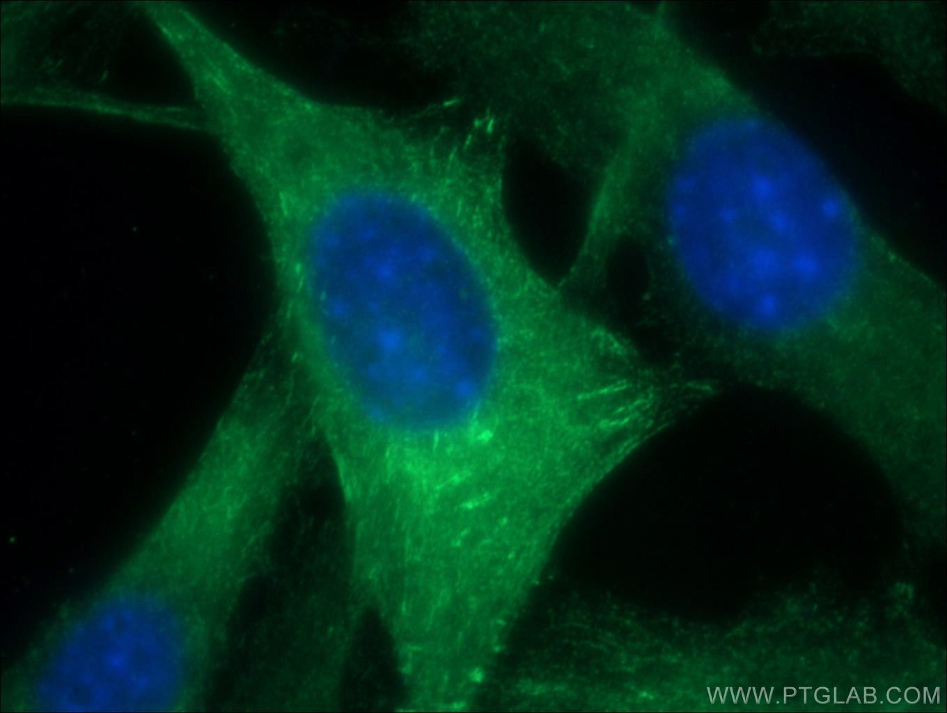 Immunofluorescence (IF) / fluorescent staining of NIH/3T3 cells using ACTN2 Polyclonal antibody (14221-1-AP)