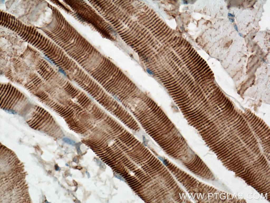 Immunohistochemistry (IHC) staining of mouse skeletal muscle tissue using ACTN2 Polyclonal antibody (14221-1-AP)