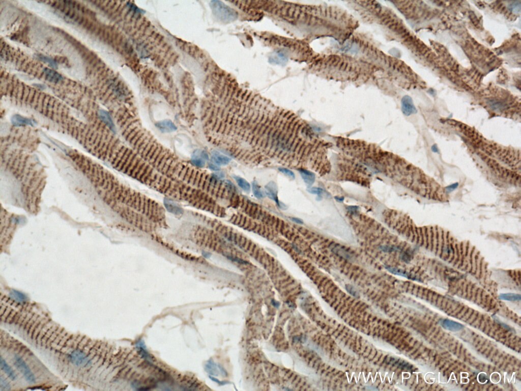 Immunohistochemistry (IHC) staining of mouse heart tissue using ACTN2 Polyclonal antibody (14221-1-AP)