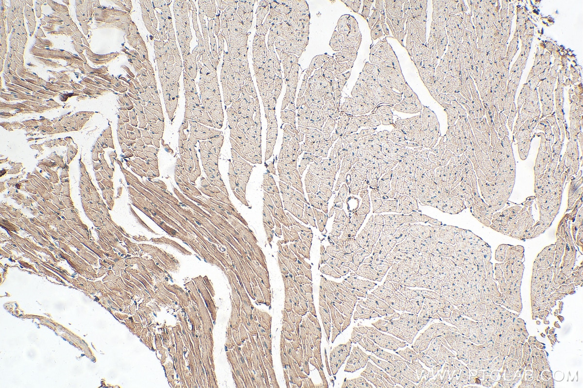 Immunohistochemistry (IHC) staining of mouse heart tissue using ACTN2 Polyclonal antibody (14221-1-AP)