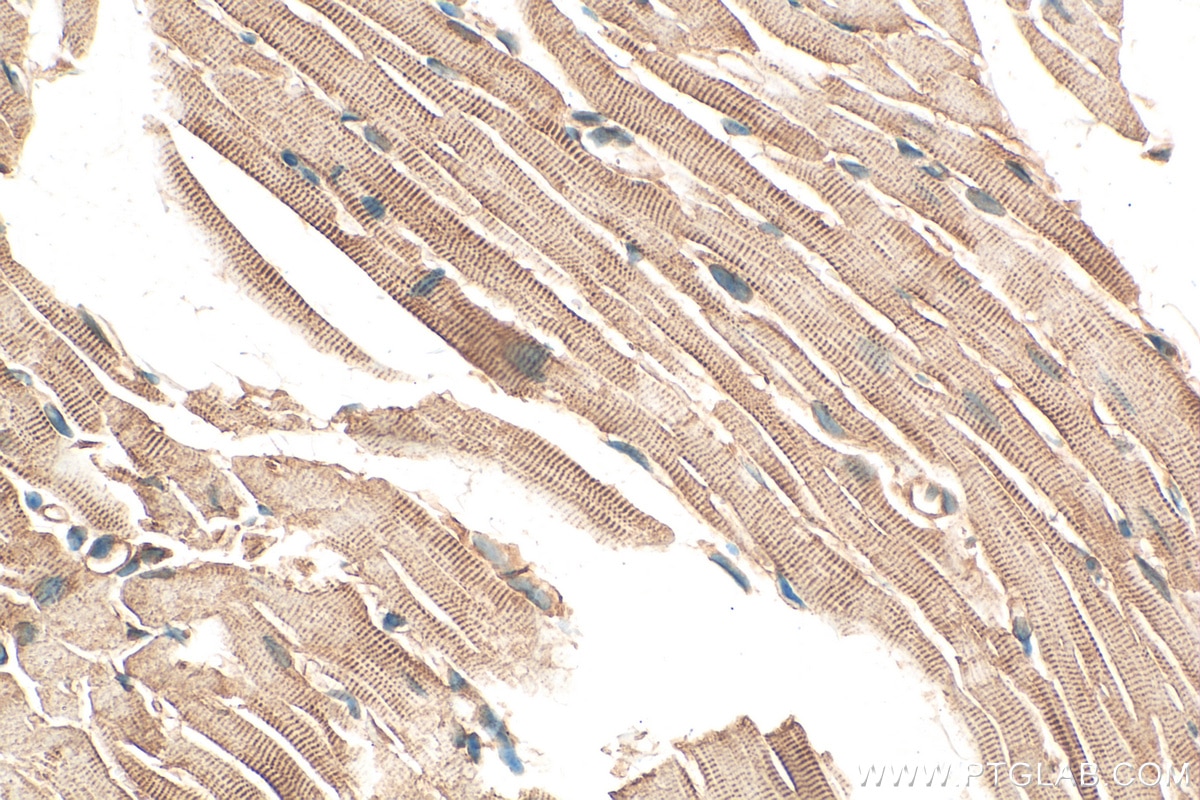 IHC staining of mouse heart using 14221-1-AP