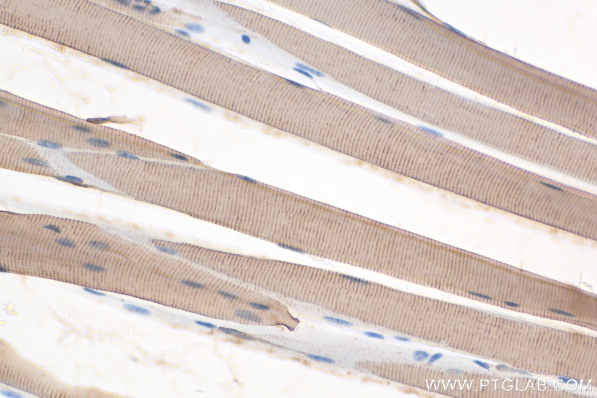 Immunohistochemistry (IHC) staining of mouse skeletal muscle tissue using ACTN2 Polyclonal antibody (14221-1-AP)