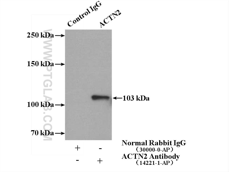 Immunoprecipitation (IP) experiment of HeLa cells using ACTN2 Polyclonal antibody (14221-1-AP)