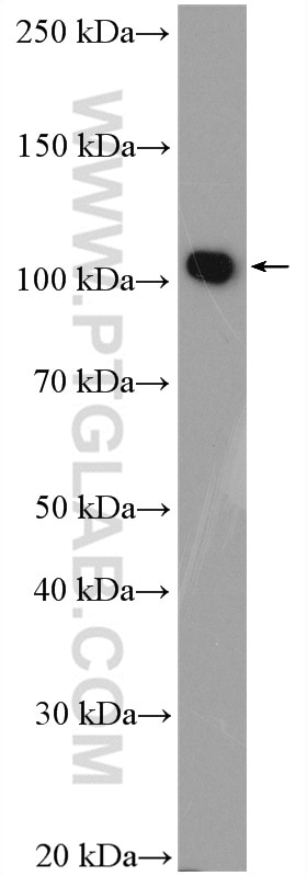 Western Blot (WB) analysis of mouse lung tissue using ACTN2 Polyclonal antibody (14221-1-AP)