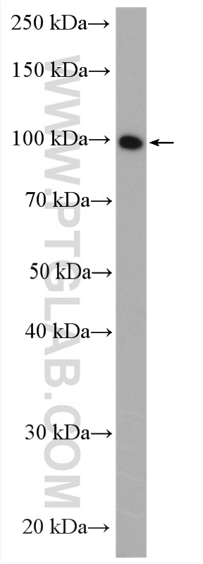 Western Blot (WB) analysis of C2C12 cells using ACTN2 Polyclonal antibody (14221-1-AP)