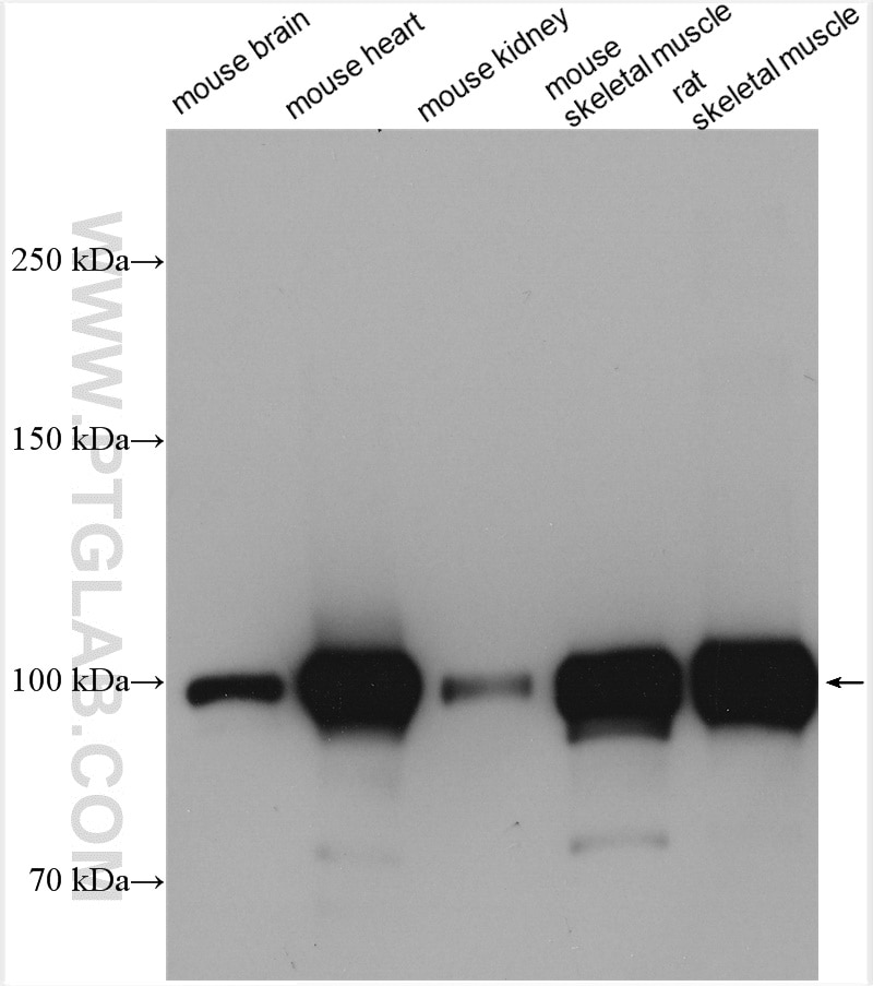 Western Blot (WB) analysis of various lysates using ACTN2 Polyclonal antibody (14221-1-AP)