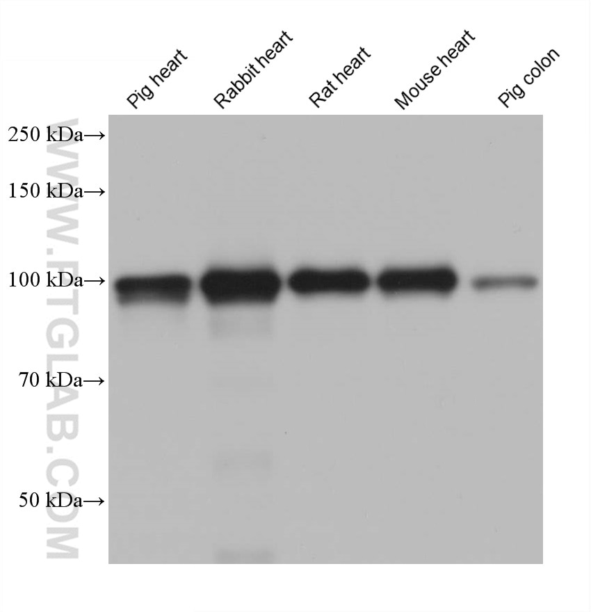 Western Blot (WB) analysis of various lysates using ACTN2 Monoclonal antibody (68223-1-Ig)