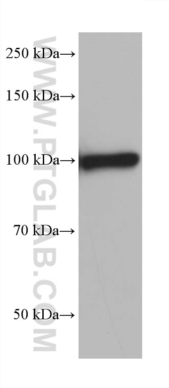 Western Blot (WB) analysis of rat colon tissue using ACTN2 Monoclonal antibody (68223-1-Ig)