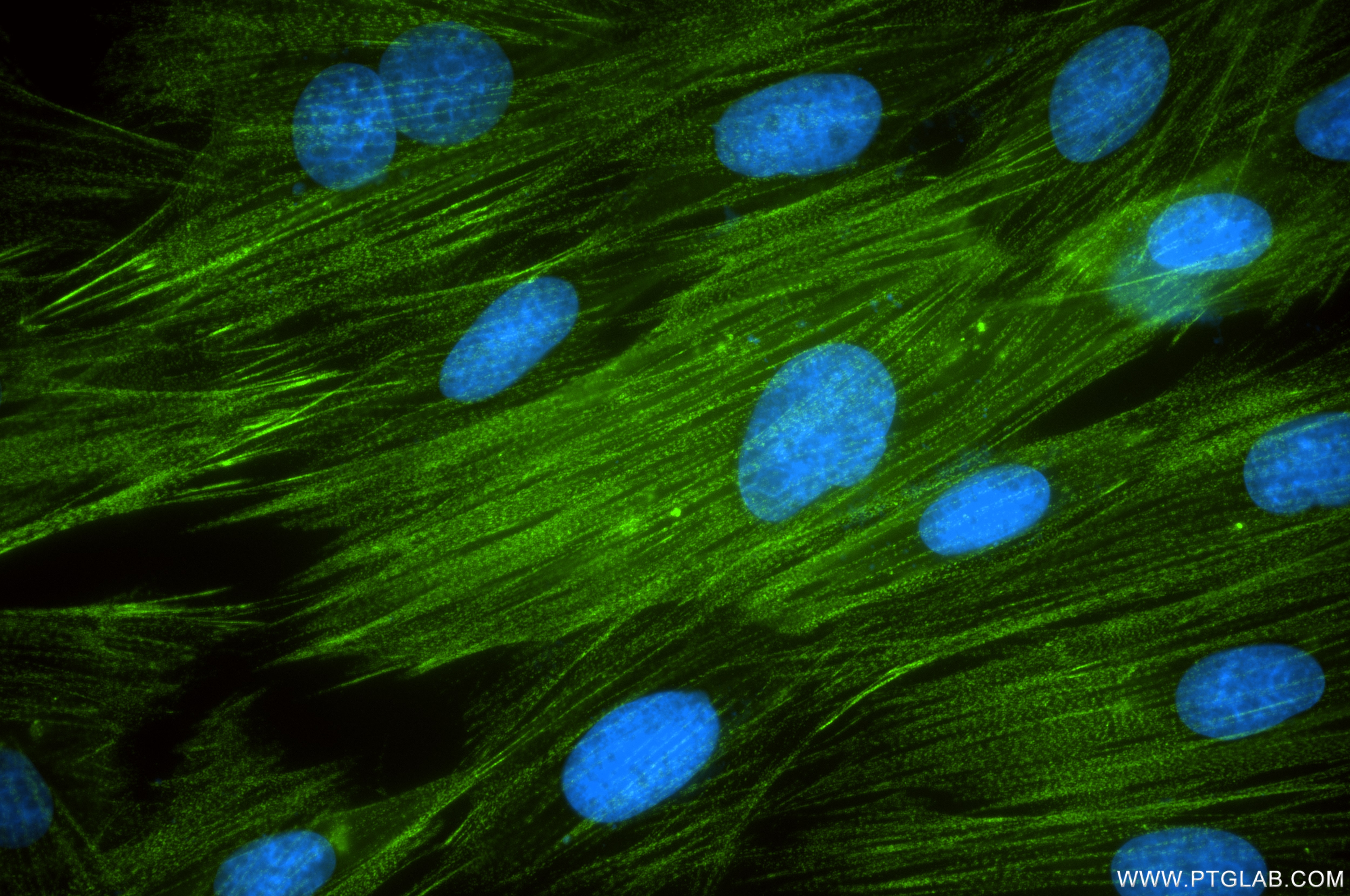 Immunofluorescence (IF) / fluorescent staining of H9C2 cells using ACTN2 Recombinant antibody (85857-4-RR)