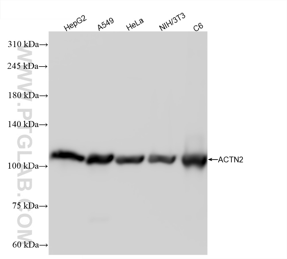 ACTN2