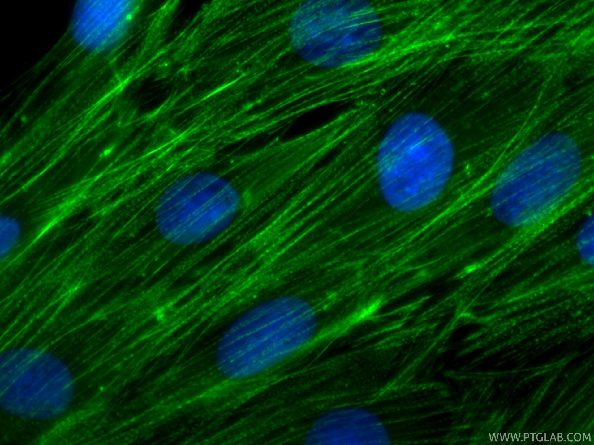 Immunofluorescence (IF) / fluorescent staining of H9C2 cells using CoraLite® Plus 488-conjugated ACTN2 Recombinant mo (CL488-85857-4)
