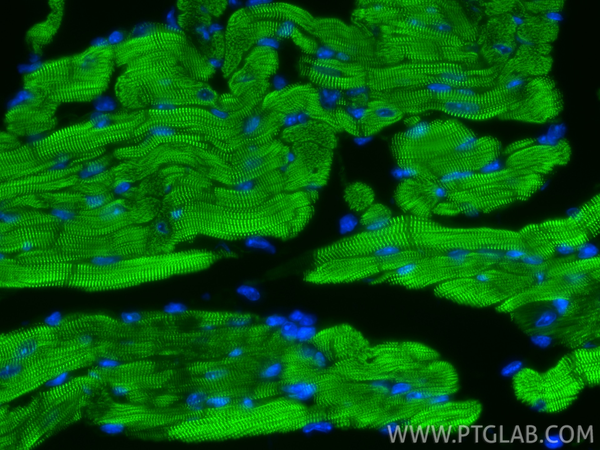 IF Staining of mouse heart using CL488-85857-4 Immunofluorescence (IF) / fluorescent staining of mouse heart tissue using CoraLite® Plus 488-conjugated ACTN2 Recombinant mo (CL488-85857-4)