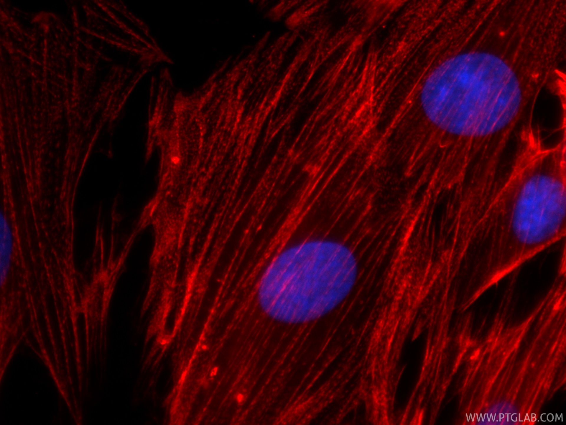 Immunofluorescence (IF) / fluorescent staining of H9C2 cells using CoraLite®594-conjugated ACTN2 Recombinant monoclon (CL594-85857-4)