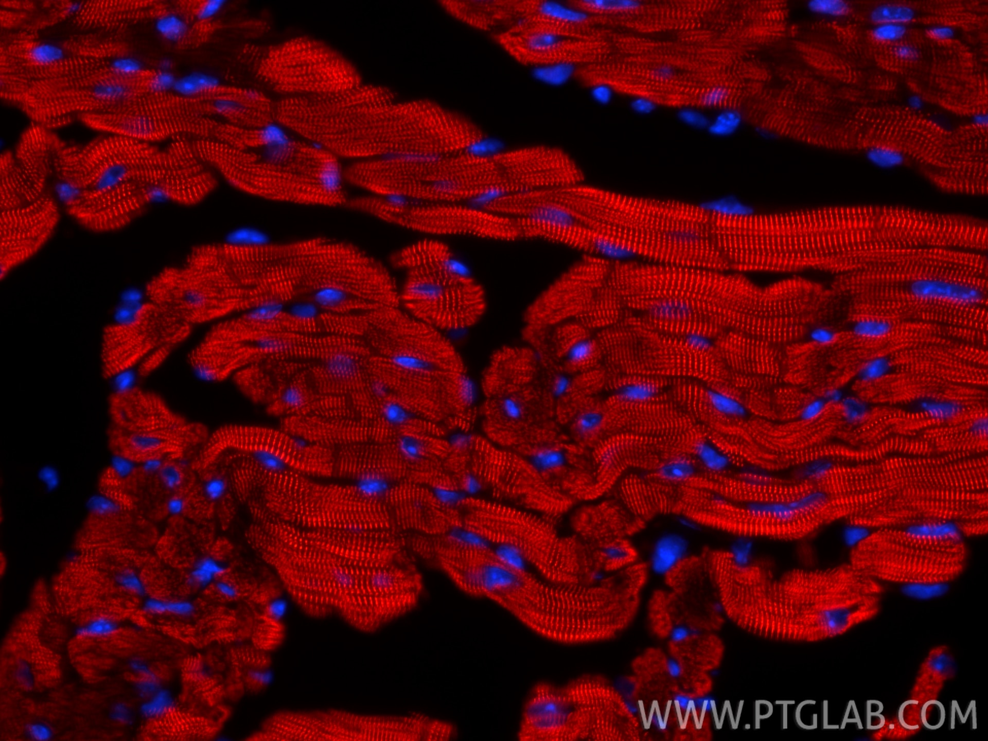 Immunofluorescence (IF) / fluorescent staining of mouse heart tissue using CoraLite®594-conjugated ACTN2 Recombinant monoclon (CL594-85857-4)