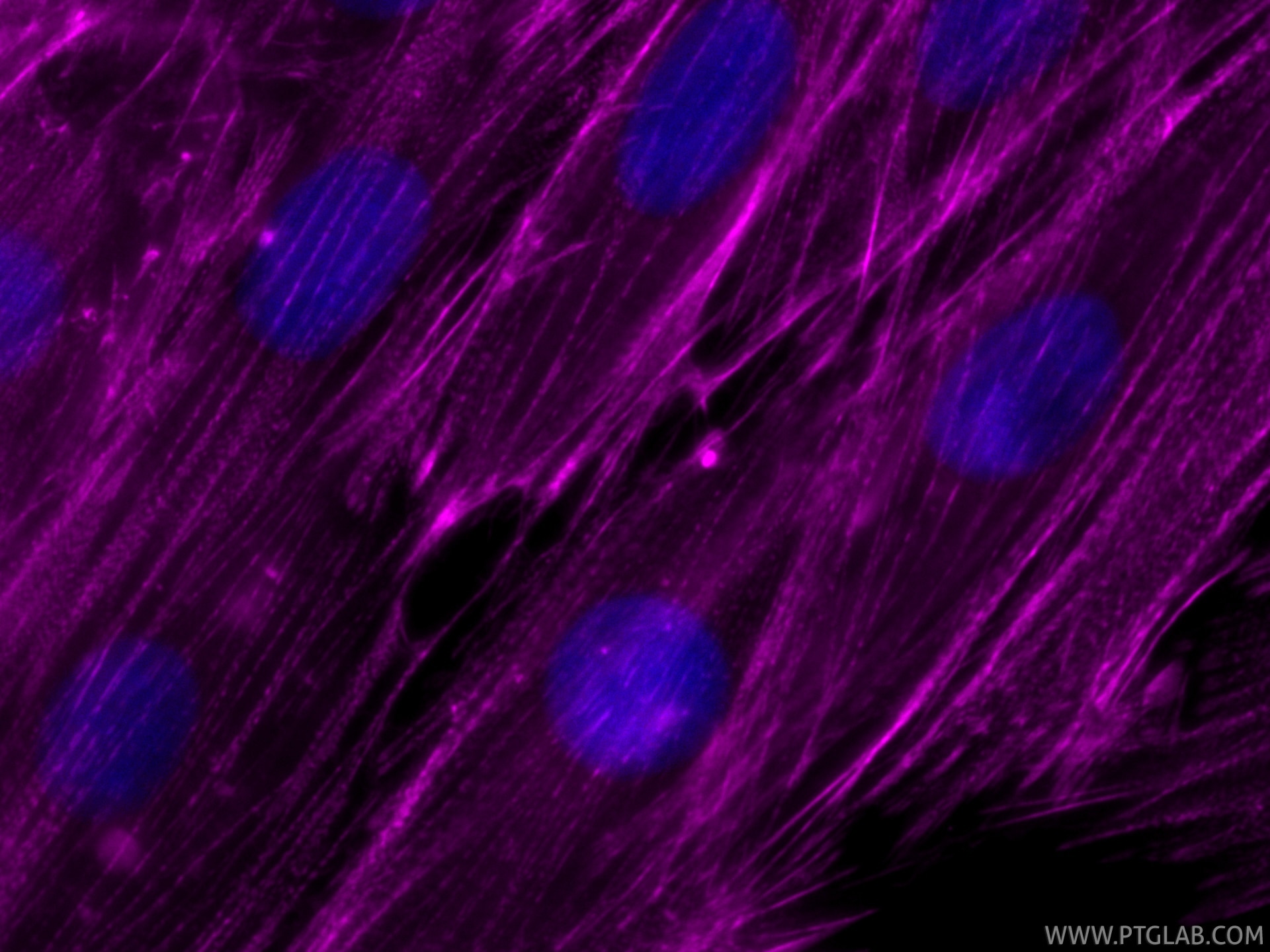 Immunofluorescence (IF) / fluorescent staining of H9C2 cells using CoraLite® Plus 647-conjugated ACTN2 Recombinant mo (CL647-85857-4)
