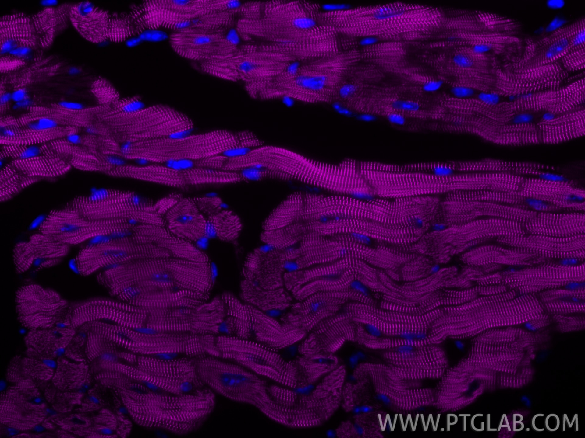 IF Staining of mouse heart using CL647-85857-4 Immunofluorescence (IF) / fluorescent staining of mouse heart tissue using CoraLite® Plus 647-conjugated ACTN2 Recombinant mo (CL647-85857-4)