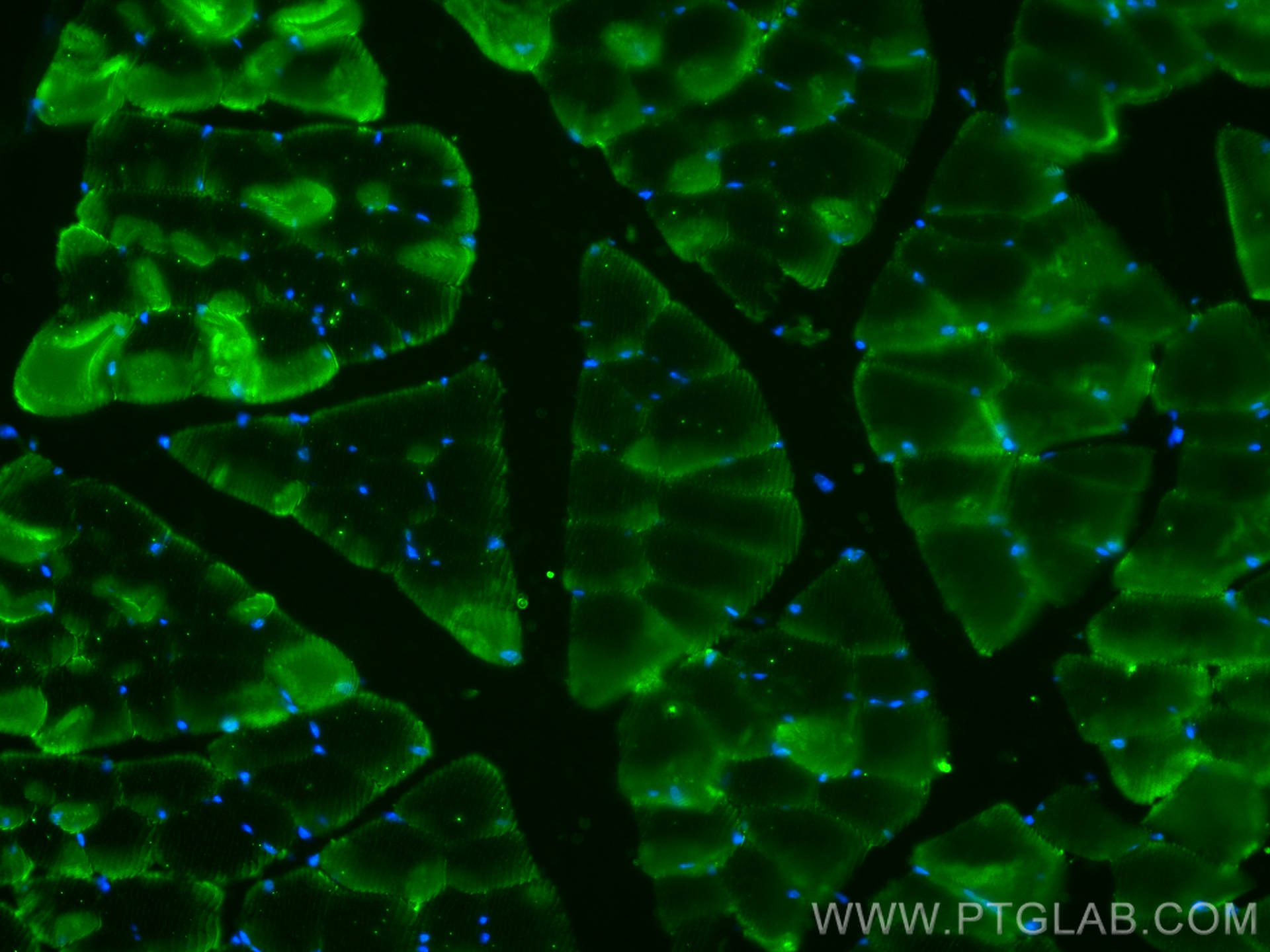 Immunofluorescence (IF) / fluorescent staining of mouse skeletal muscle tissue using ACTN3 Polyclonal antibody (24378-1-AP)
