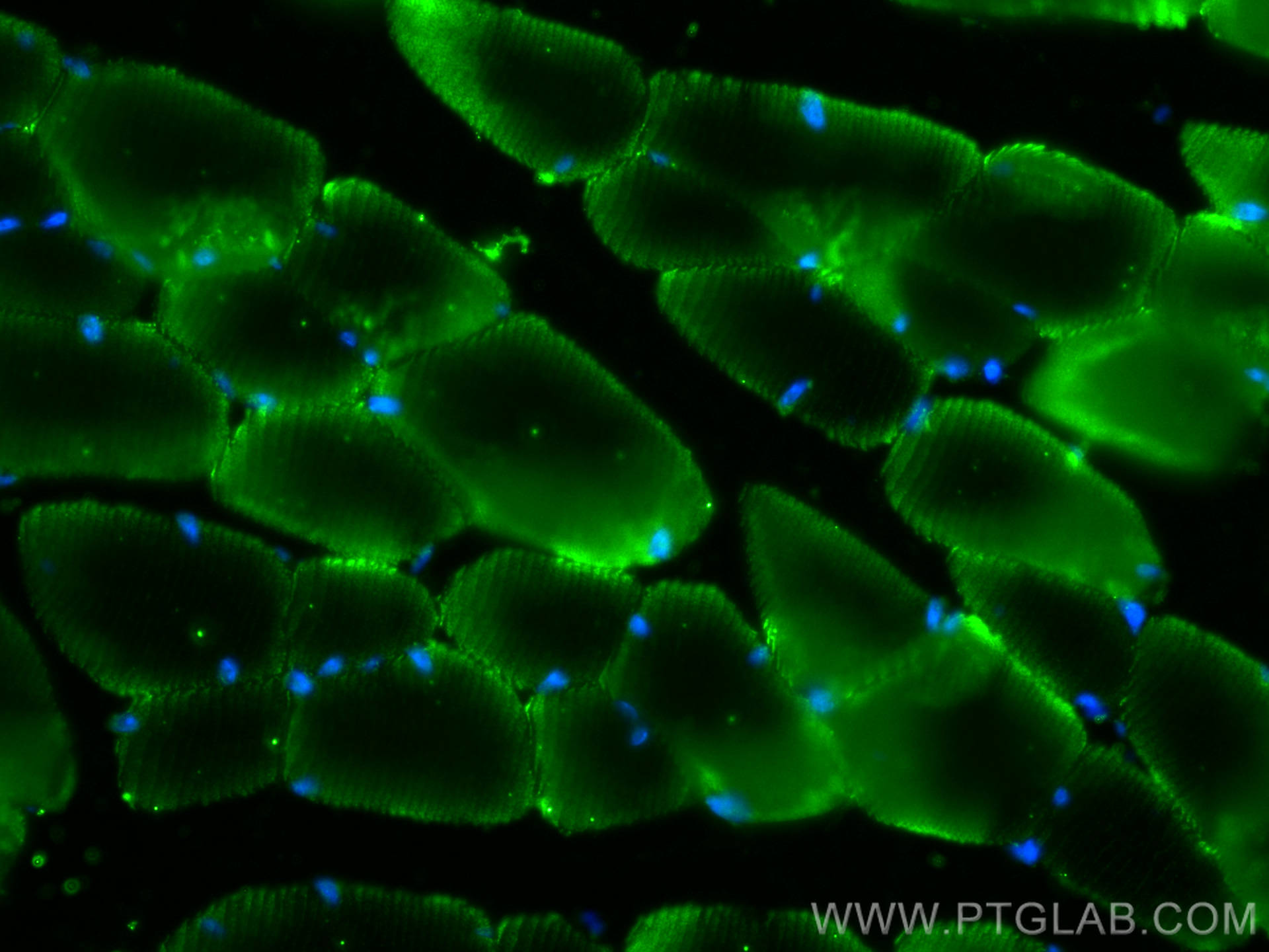 IF Staining of mouse skeletal muscle using 24378-1-AP
