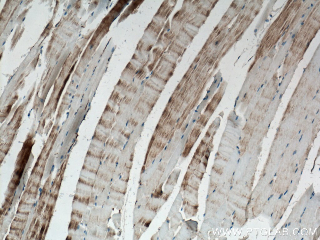 Immunohistochemistry (IHC) staining of mouse skeletal muscle tissue using ACTN3 Polyclonal antibody (24378-1-AP)