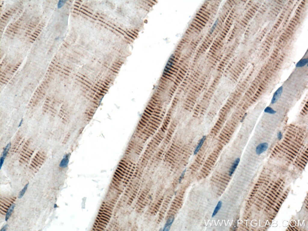 Immunohistochemistry (IHC) staining of mouse skeletal muscle tissue using ACTN3 Polyclonal antibody (24378-1-AP)