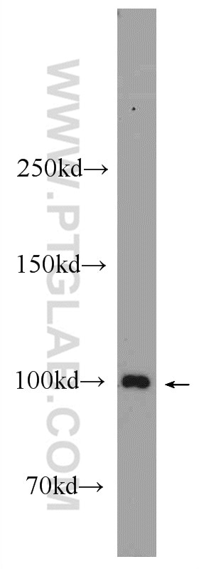 Western Blot (WB) analysis of mouse skeletal muscle tissue using ACTN3 Polyclonal antibody (24378-1-AP)