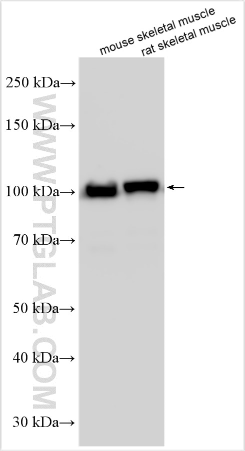 Western Blot (WB) analysis of various lysates using ACTN3 Polyclonal antibody (24378-1-AP)