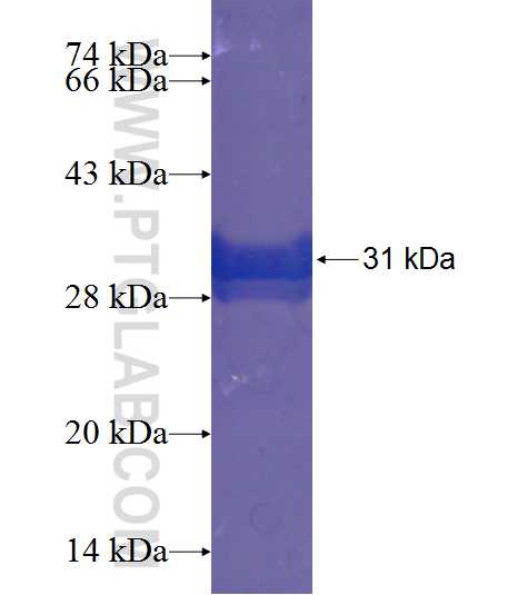 ACTN3 fusion protein Ag19479 SDS-PAGE