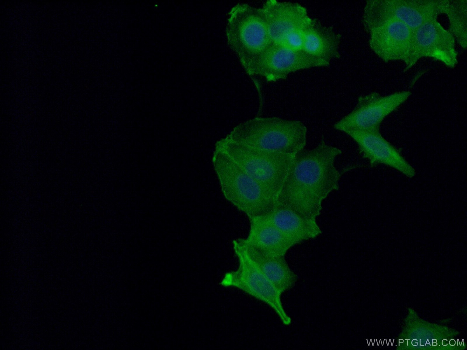 Immunofluorescence (IF) / fluorescent staining of MCF-7 cells using ACTN4 Polyclonal antibody (19096-1-AP)