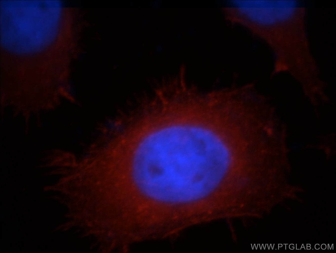 Immunofluorescence (IF) / fluorescent staining of MCF-7 cells using ACTN4 Polyclonal antibody (19096-1-AP)