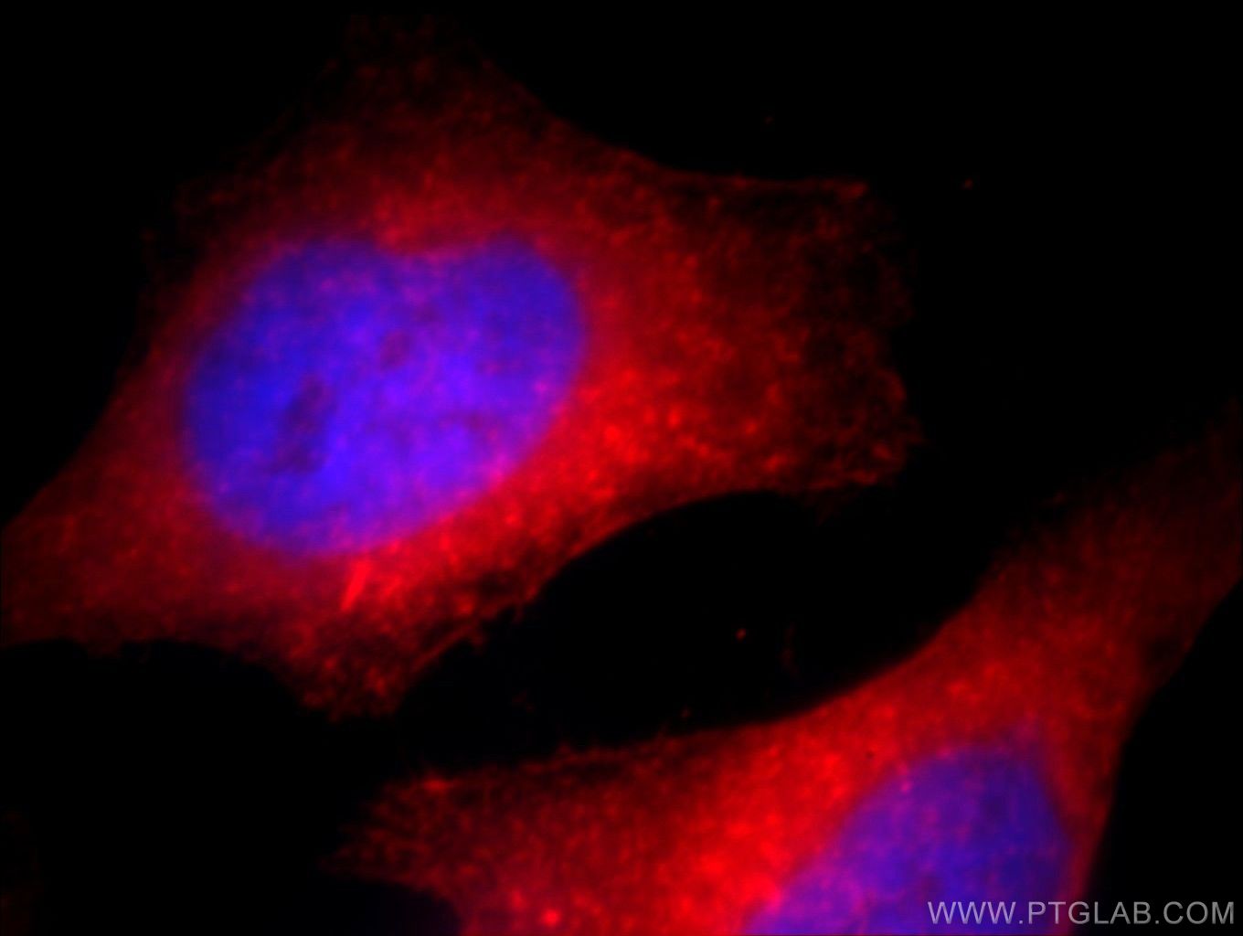 IF Staining of HeLa using 19096-1-AP