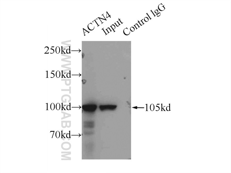 Immunoprecipitation (IP) experiment of HeLa cells using ACTN4 Polyclonal antibody (19096-1-AP)