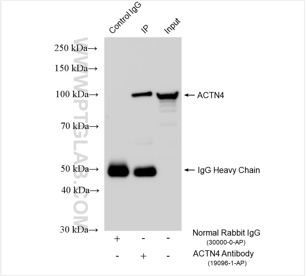 Immunoprecipitation (IP) experiment of HeLa cells using ACTN4 Polyclonal antibody (19096-1-AP)