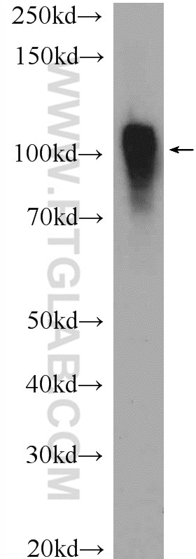 Western Blot (WB) analysis of mouse liver tissue using ACTN4 Polyclonal antibody (19096-1-AP)