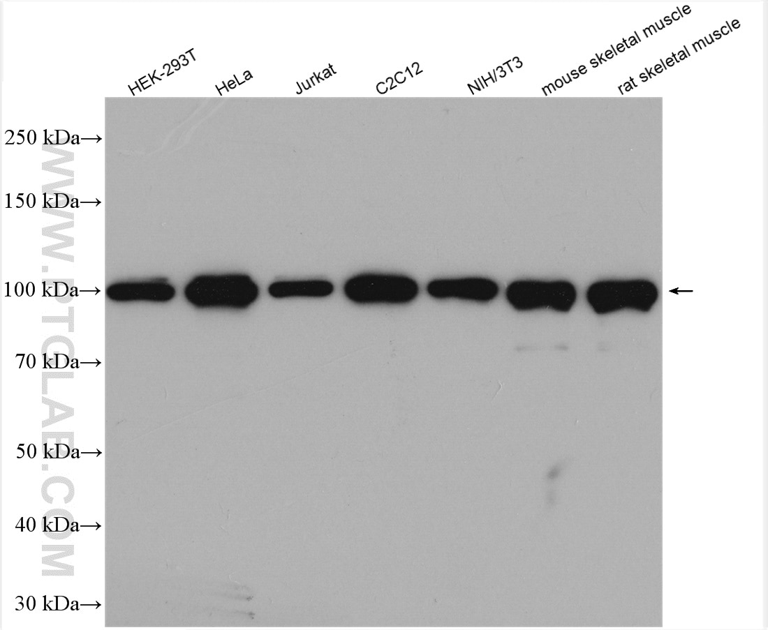 Western Blot (WB) analysis of various lysates using ACTN4 Polyclonal antibody (19096-1-AP)