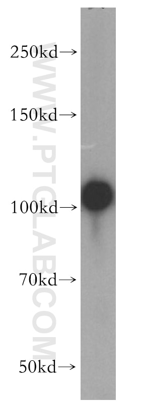 ACTN4 Polyclonal antibody