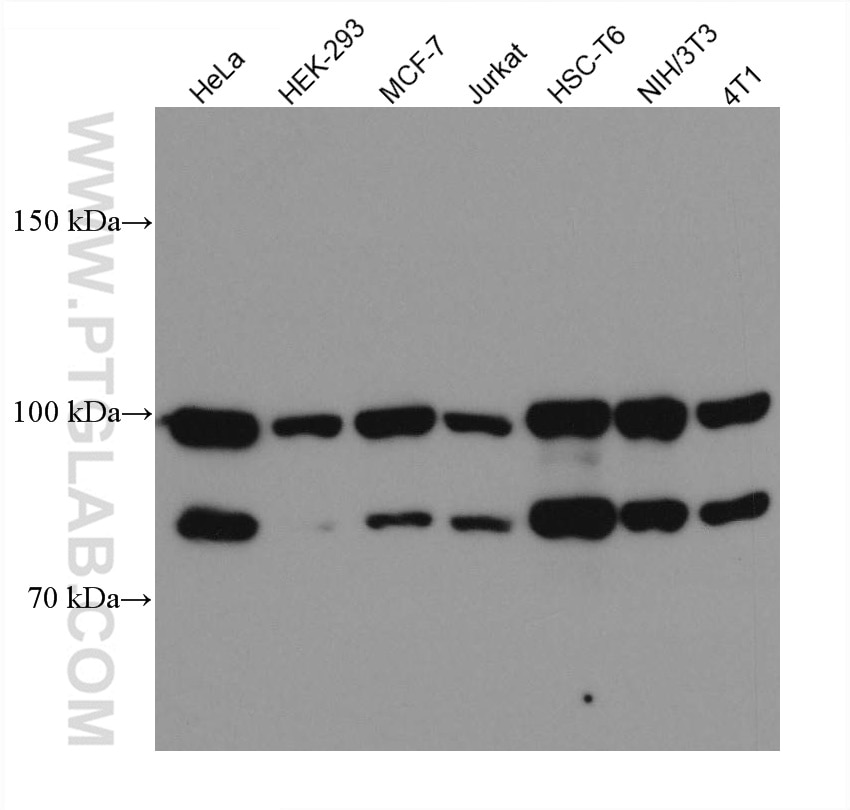 Western Blot (WB) analysis of various lysates using ACTN4 Monoclonal antibody (66628-1-Ig)