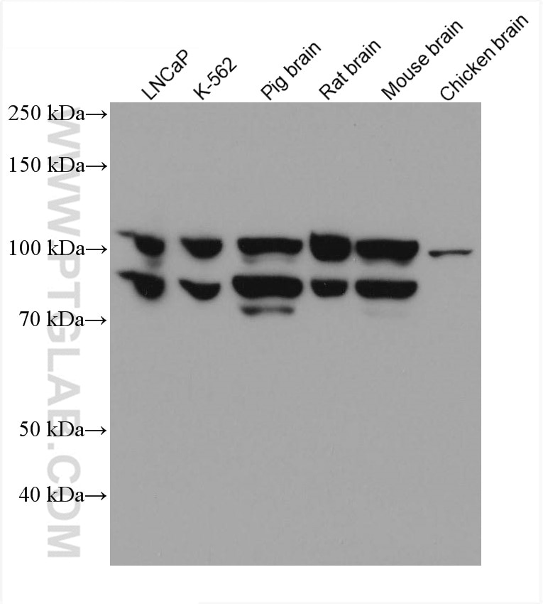 Western Blot (WB) analysis of various lysates using ACTN4 Monoclonal antibody (66628-1-Ig)