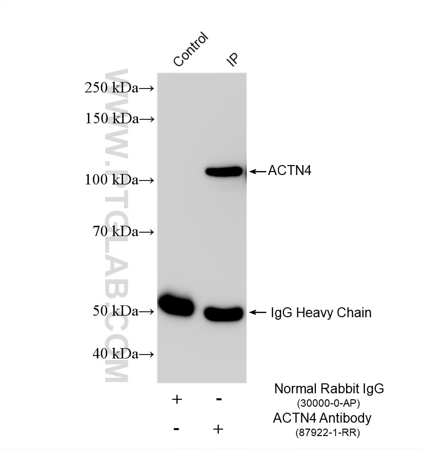 Immunoprecipitation (IP) experiment of HeLa cells using ACTN4 Recombinant monoclonal antibody (87922-1-RR)